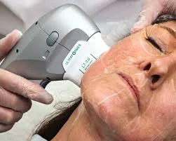 Imagen de HIFU Corporal en Maradia Estética