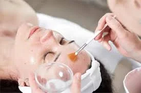 Imagen de Peeling Químico en Maradia Estética